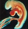 Ora comincia lo sviluppo della placenta.